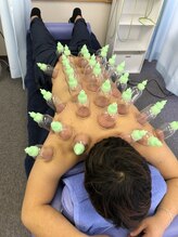 リアン整体院/クセになるカッピング◎郡山
