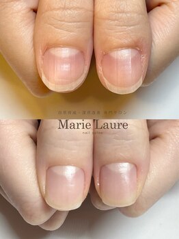 マリーロール 梅田店(Marie Laure)/自爪育成/深爪矯正/ネイルケア