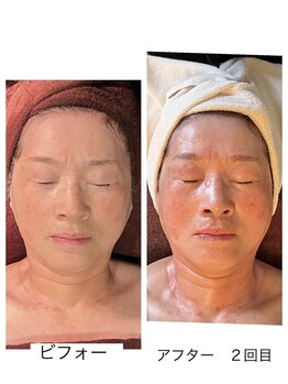 アンレーブ(an'reve)/【エアジェット2回目】