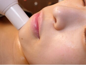 痩身 脱毛専門サロン 椿の写真/【小顔エステ・脂肪分解剤注入】で、気になる二重顎やブルドック顔を撃退◎理想のフェイスラインに♪