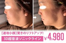 アネル 新都心店(anel)