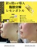 《ニ重顎/マリオネット/小顔》韓国発★次世代脂肪分解剤注入 レモンボトル2cc