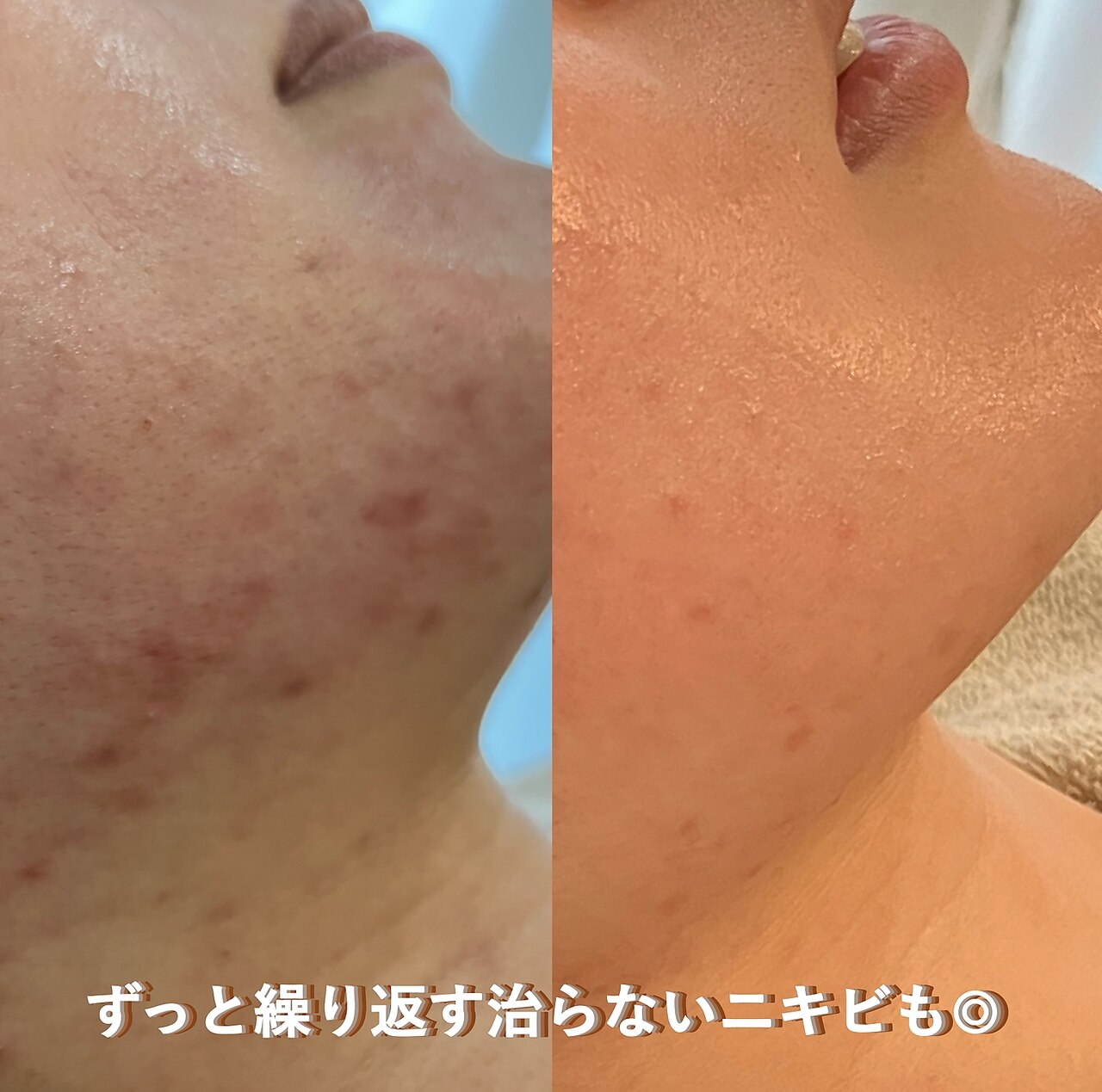 【リアン】Lien ファヴェール メリテッドエッセンス【期間限定！値下げ中！】 リアン(Lien)｜ホットペッパービューティー