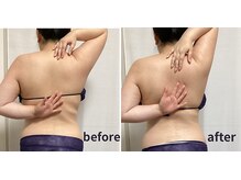 ケイ(K)/背中がほぐれて可動域もアップ！