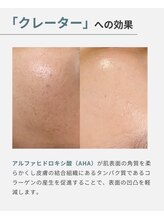 オフモード(OffMode)/内側からふっくら♪