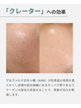 オフモード(OffMode)/内側からふっくら♪