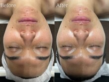 ルミナ シブヤ(LUMINA SHIBUYA)/【ダクトピール】1回目　正面