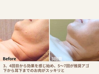 ヨガ アンド リラクゼーション からだの恵み 安城サロン/