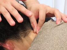 えんしん整骨院 琴似院の雰囲気（鍼灸施術）