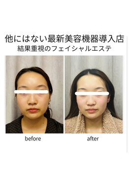 キュララ(KYURARA)/他店と差がつく最新マシン！