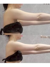 ユニ(uni.)/痩身症例