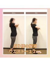 えのもと美容整体院/【反り腰の解消】