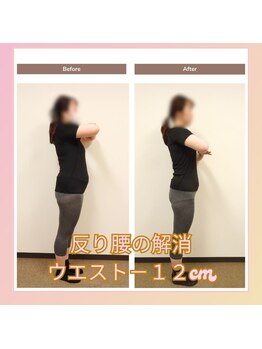 えのもと美容整体院/【反り腰の解消】