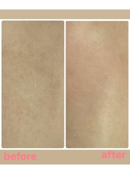 ジョエルワックス 沖縄糸満店(JOELLE WAX)/セットでお得!