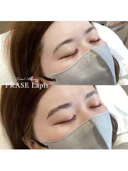 フレイズラピス(FRASE Lapis)/【ハリウッドブロウリフト】