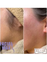 エリス(ELISSE)/部分ワックス【もみあげ】