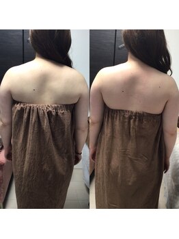 マイントゥー(mine too)/背肉すっきり