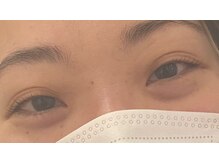 ビューティーアミューズメント 山鼻店(BEAUTY AMUSEMENT)/岩切3月　8