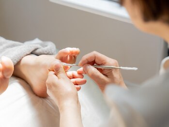 楽ーんの写真/＼フットケア専門店／【長年お爪にお悩みがある方必見】欠け爪、割れ爪、トラブル爪は当店にお任せ下さい◎