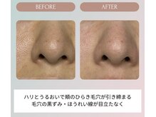 ノーブル(NOBLE)/ムートンホイップスパ大阪/野田