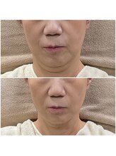 メイス 福井店(MEIS)/お客様before、after