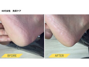 ふっとけ庵/足裏角質ケア(かかと)