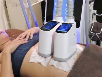 シャンティ(Shanti)の写真/【脂肪冷却2部位¥8000】本気で痩せたい方間に合わせたい予定がある方こそお任せを!