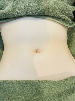 スターフォート(Star fort)/お腹もみ