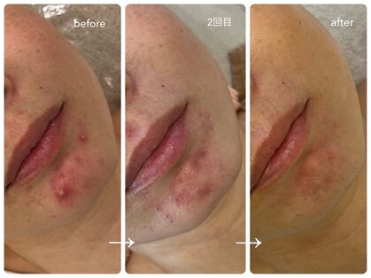 ナポデイズ(NAPODAYS)の写真