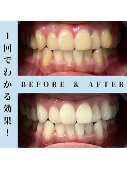 ドルチェ 水戸店(Dolce)/★ before → after ★