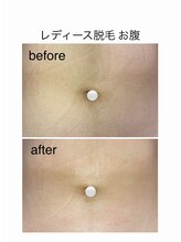 アオドットアール(Ao.r)/