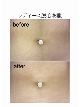 アオドットアール(Ao.r)/
