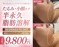 ウィンウィン 新山口店(Win Win)