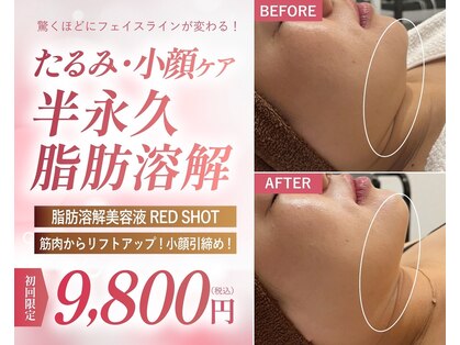ウィンウィン 新山口店(Win Win)の写真
