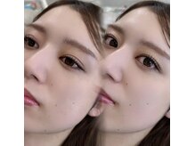 ペレアイラッシュ(Pele Eyelash)の雰囲気（最新技術有り○ ティントパーマ/エクステ高持続プライマー）