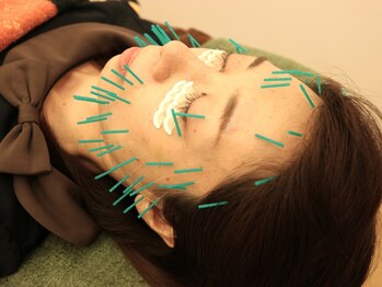 はしもと鍼灸整骨院/◇施術