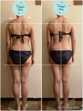 カレン/軟部組織のリリース