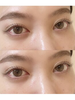 アイラッシュプラン リノ(eyelash plan RINO)/メーテルロッド