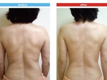 ビューティ ケア ルーム メロウ(Beauty Care Room Moelleux)/痩身before&after