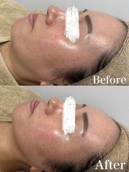 ビビィ(Bibiy)/クリスティーナ/ビオフィート