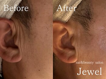 ジュエル(Jewel)/マグマハーブ一回の効果