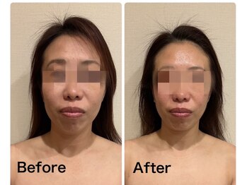 ムーロ(muro.)/コルギ