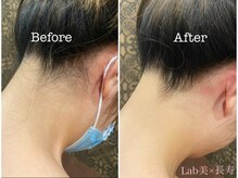 ラブ美長寿 沖縄本店(Lab)/【SHR脱毛】うなじ脱毛/全身脱毛