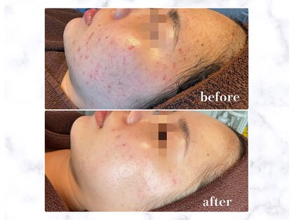 キセキ(KISEKI)の写真