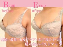 ベリンダ(belinda)