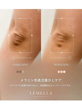 ソレラ(sorelle)/ルメラ肘