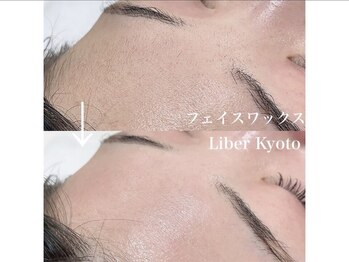 エステティック リベル キョウト 京都駅前店(Esthetic Liber Kyoto)/フェイスワックス脱毛