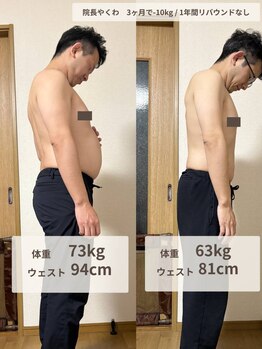 やくわ新坂町はり灸マッサージ治療院/運動なし耳つぼ×鍼灸ダイエット