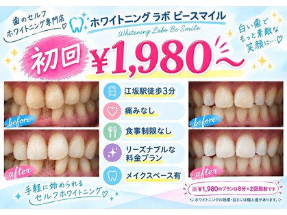 ホワイトニングラボ ビースマイル(WhiteningLabo Besmile)の写真