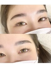 リザボーテ(Liza beate)/Hollywood brow lift